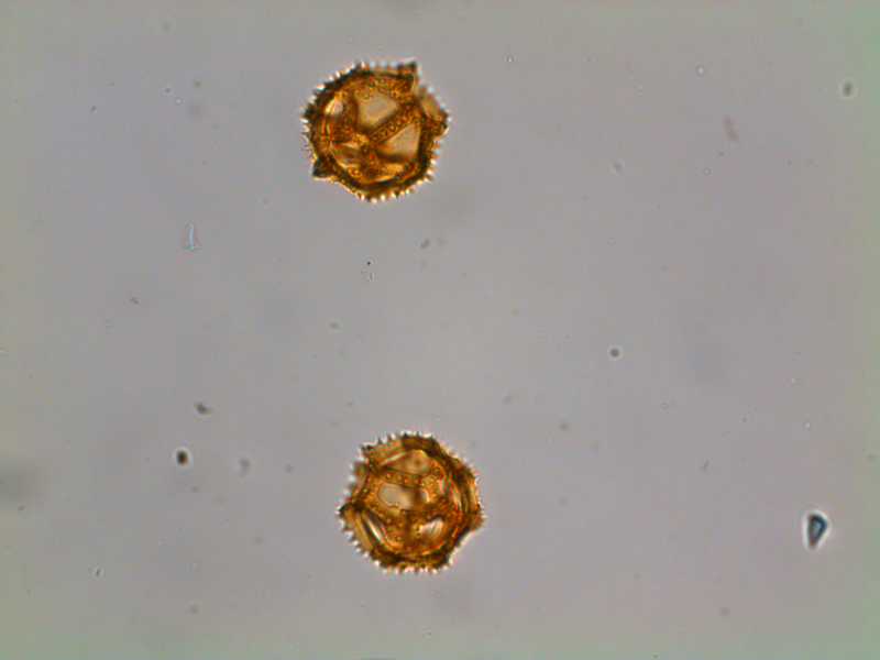 Pollenkörner, wie hier vom Löwenzahn (Taraxacum officinale), können bei betroffenen Personen Allergien auslösen. © IPS UniBE